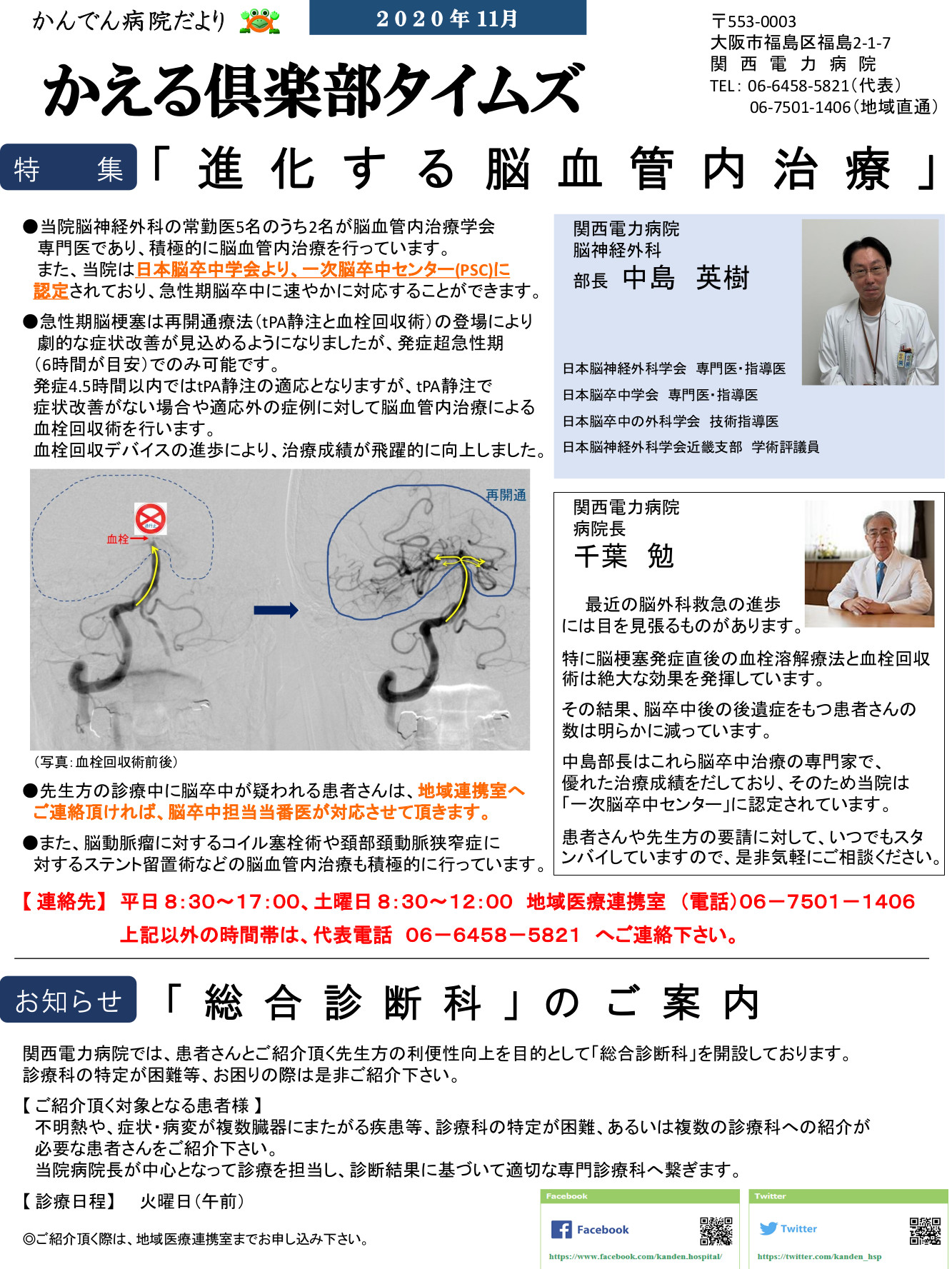 進化する脳血管内治療