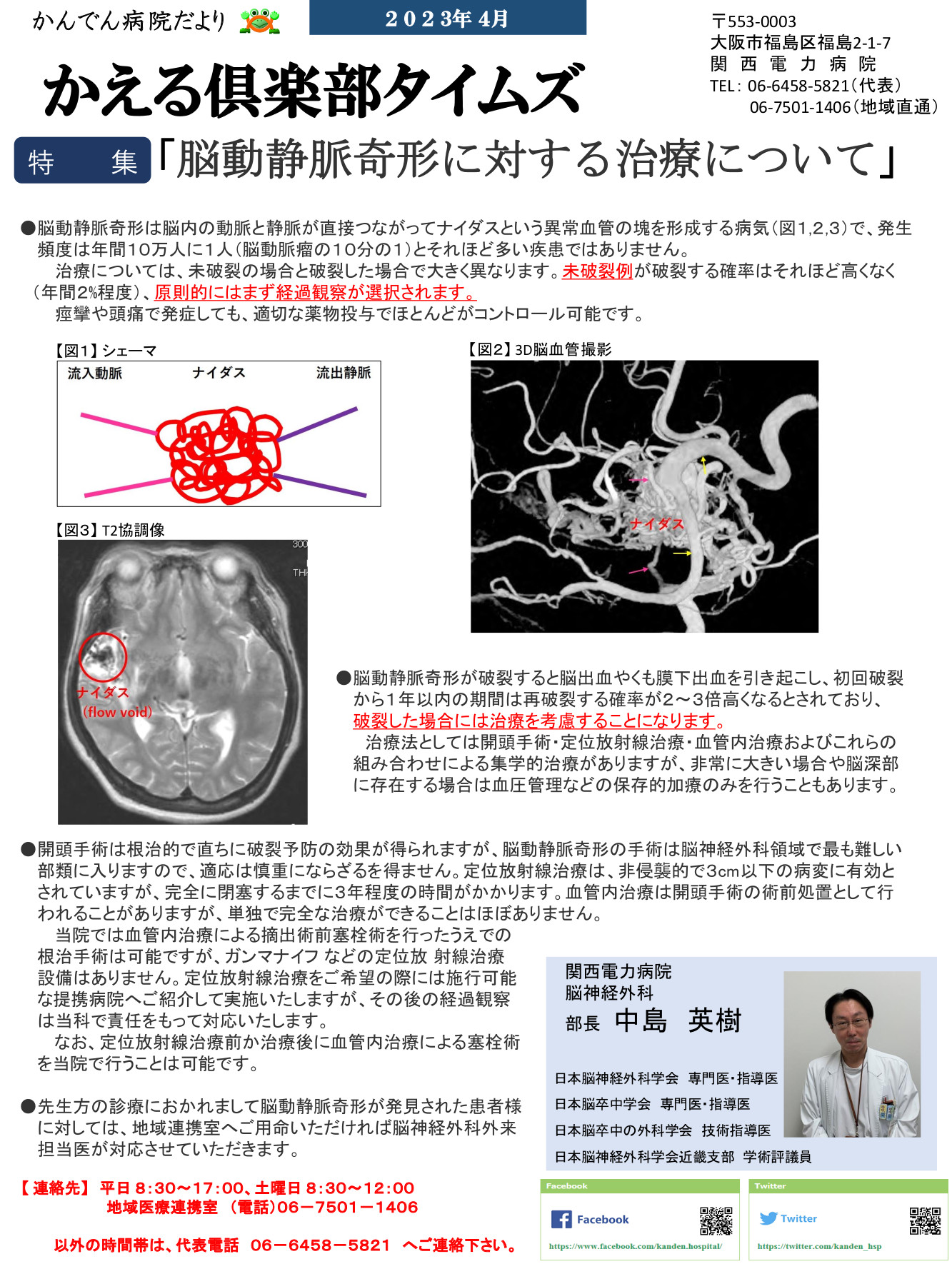 脳動静脈奇形に対する治療について