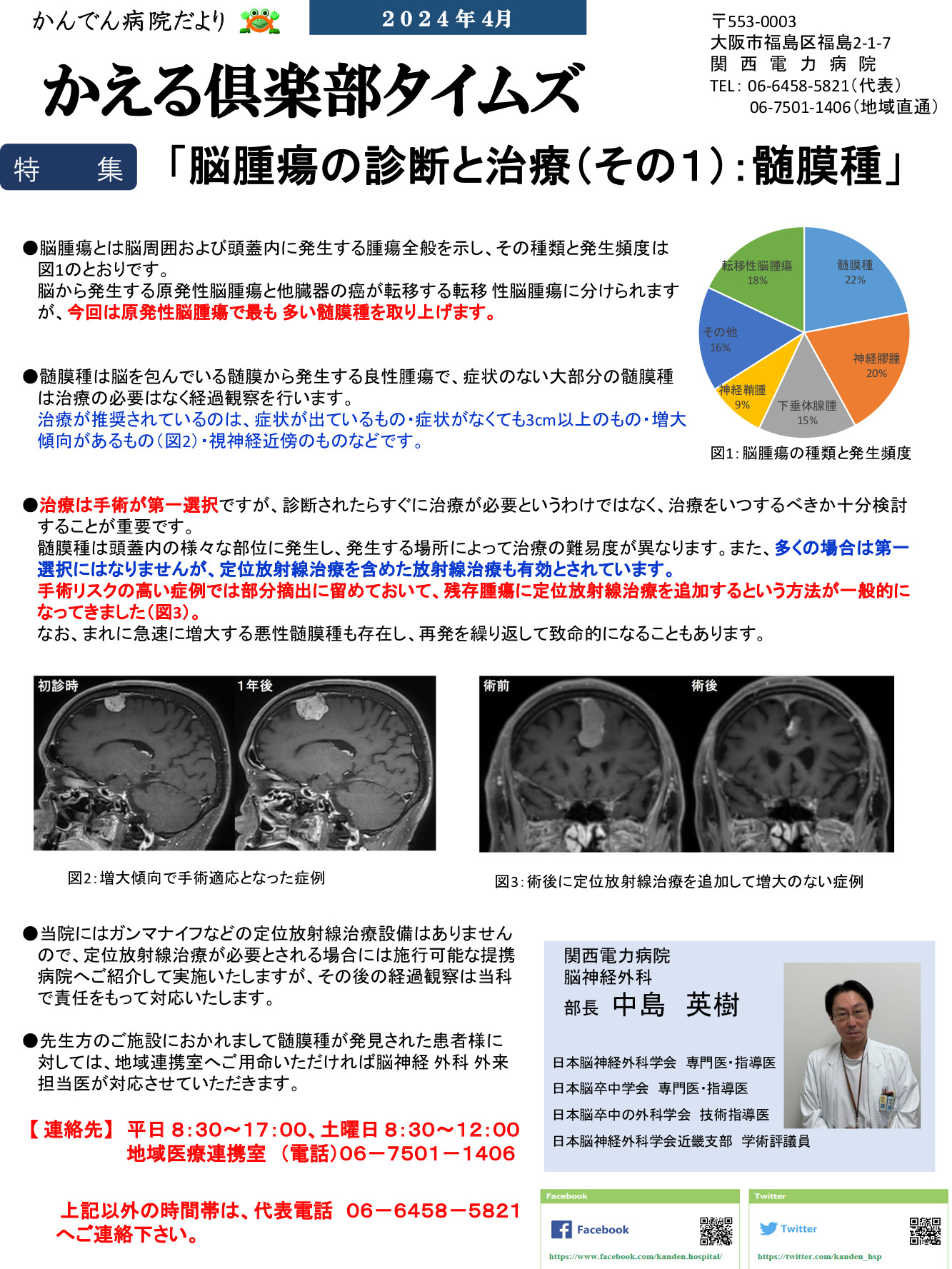 脳腫瘍の診断と治療（その１）：髄膜種