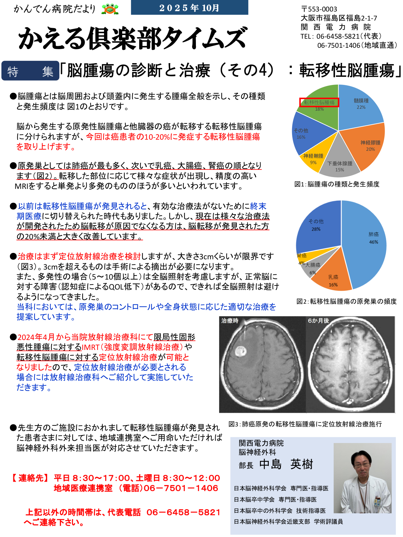 脳腫瘍の診断と治療（その４）：転移性脳腫瘍