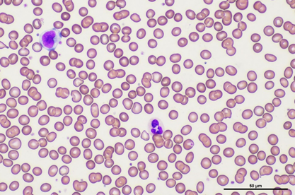 末梢血液塗抹標本(赤血球、白血球、血小板)  