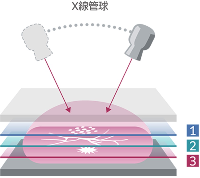 トモシンセシス説明１