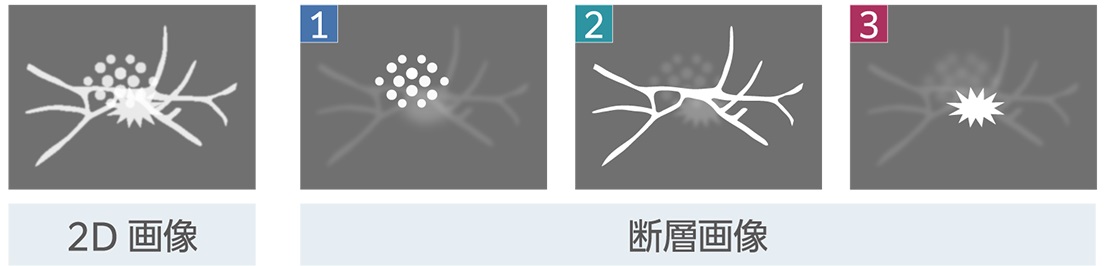 トモシンセシス説明２