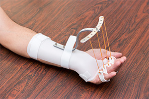 手指のリハビリテーションのために使用する装具。作業療法士が患者さまの状態に合わせてオーダーメイドで作製している画像