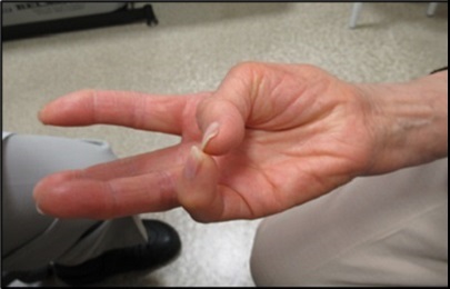 図2 指先のみ接触している状態