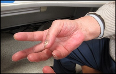 図3 全く接触できない状態